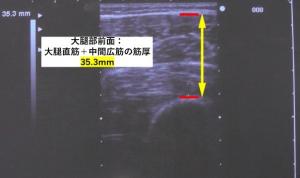 超音波診断画像