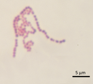 Streptococcus